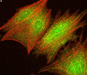 Cells, Genes and Molecules for Cardiac and Vascular Repair Cells, Genes and Molecules for Cardiac and Vascular Repair