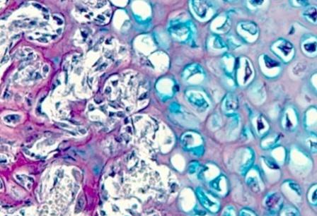 Rapporti struttura-attività di glicosaminoglicani e di nuovi anticoagulanti Rapporti struttura-attività di glicosaminoglicani e di nuovi anticoagulanti